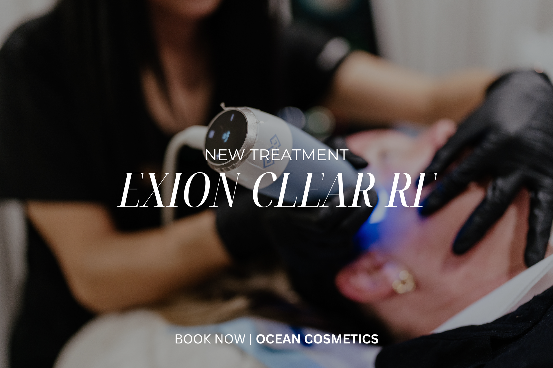 Exion Clear RF: The Future of Skin Rejuvenation at Ocean Cosmetics