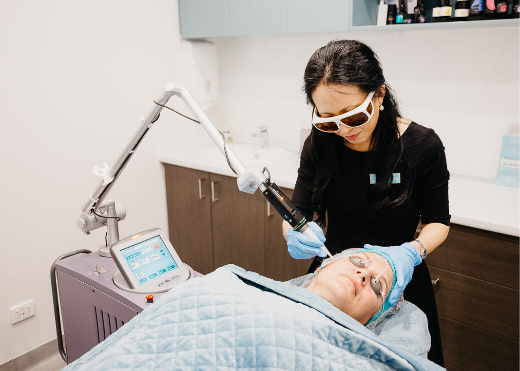 Laser Skin Treatments 101