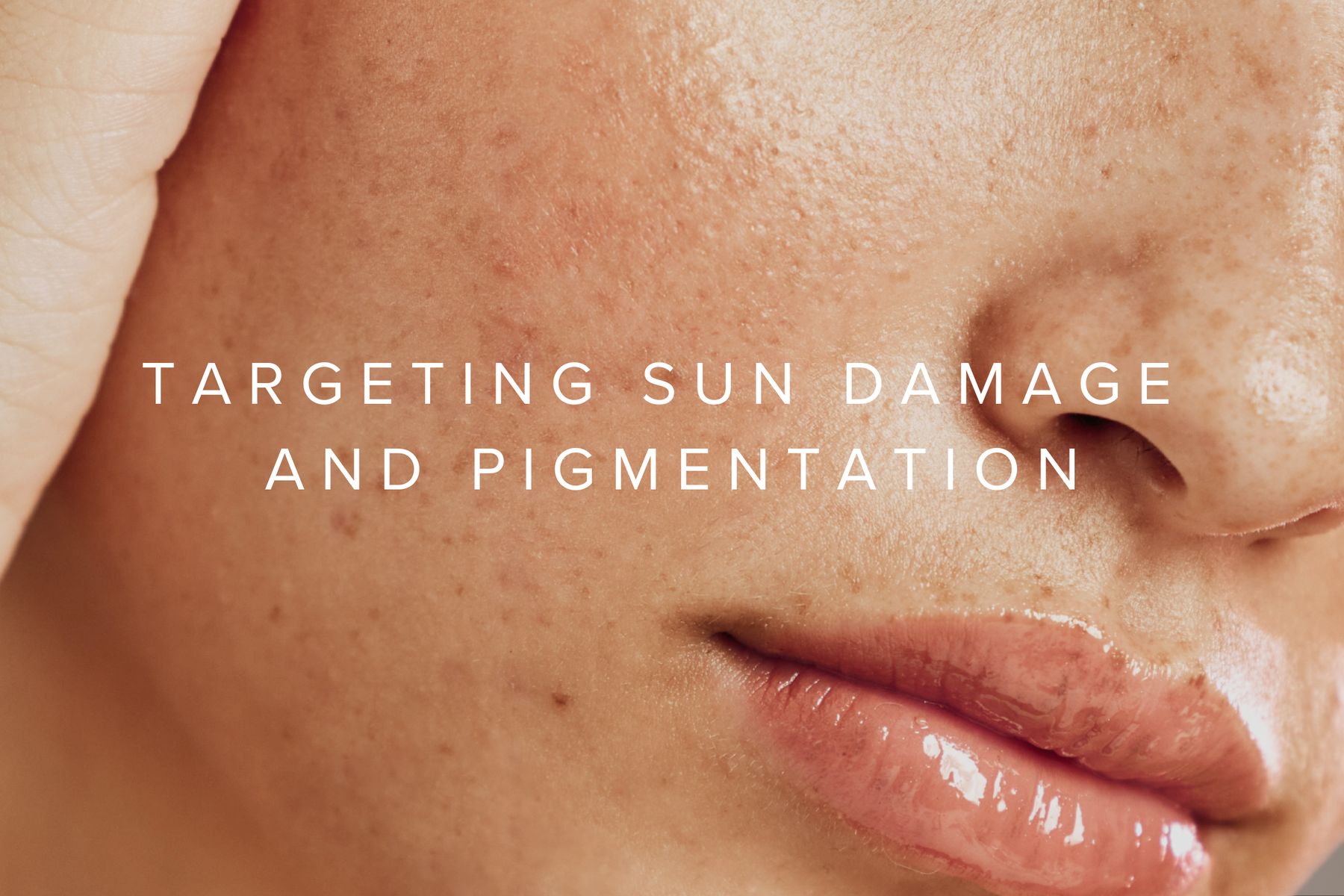 Targeting Sun Damage and Pigmentation: The Impact of Non-Ablative Fractional Laser and Broadband Light Therapy