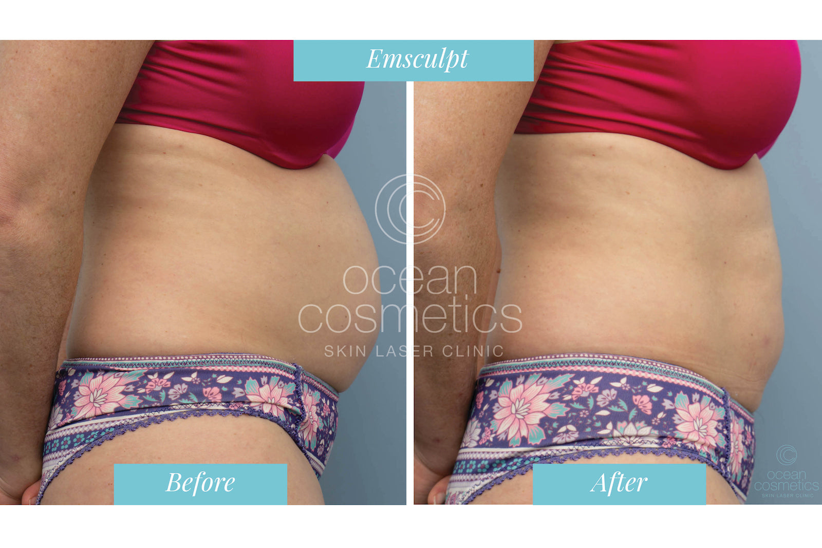 Why one device only won’t get you perfect results – Spa & Clinic