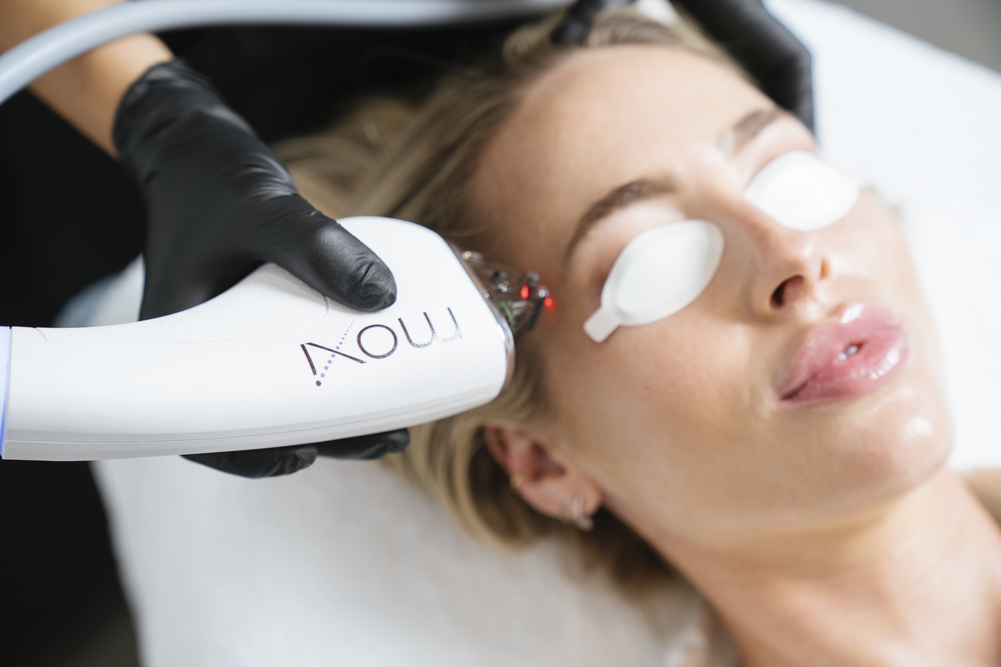 Woman receiving a laser treatment on her face with MOXI.