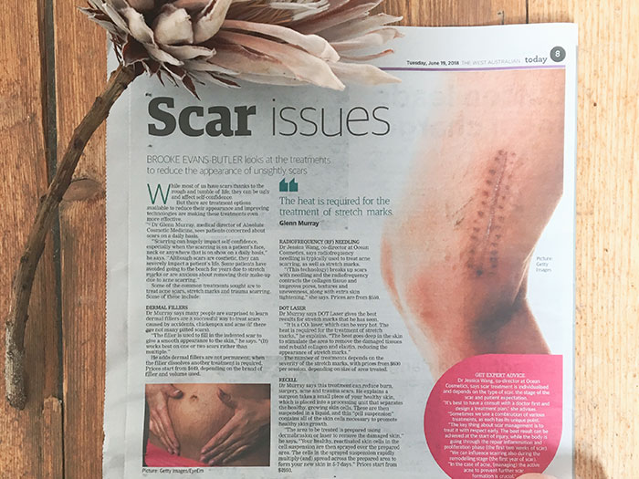 Scar Issues West Australian Scar Issues - Health + Fitness, The West Australian, 19th June 2018 - 9